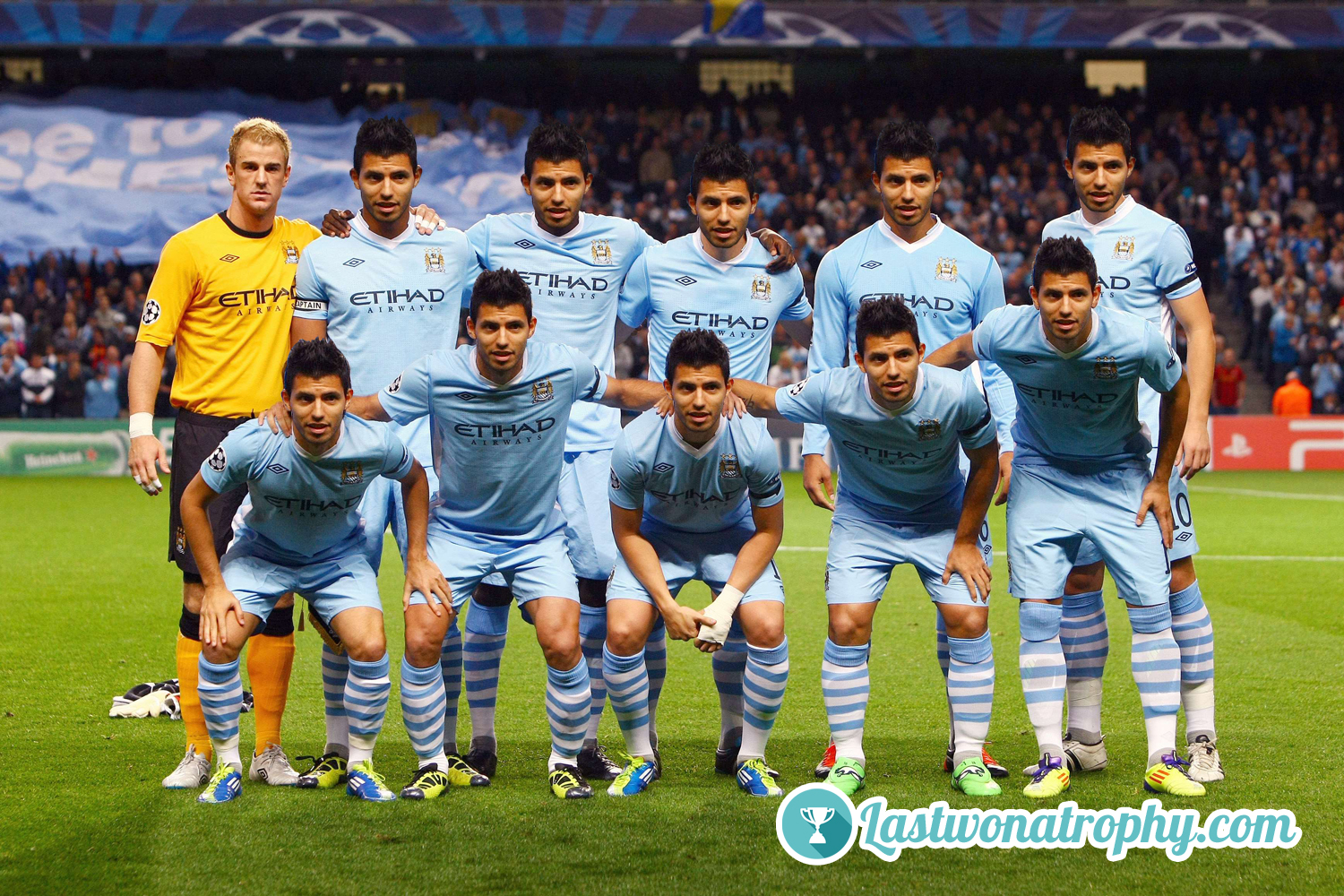 Joe Hart didn't know what to think in last nights team photo